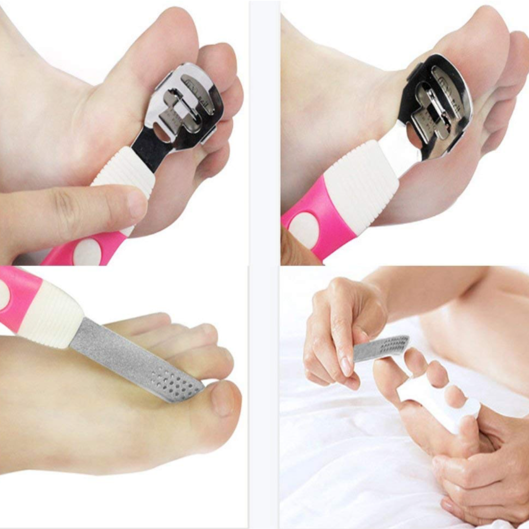 Multipurpose Foot File Callus Remover | Callus remover for feet, Corn Shaver, Hard Skin Remover (GB-3062)